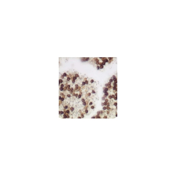 Warthin-Starry Stain Kit